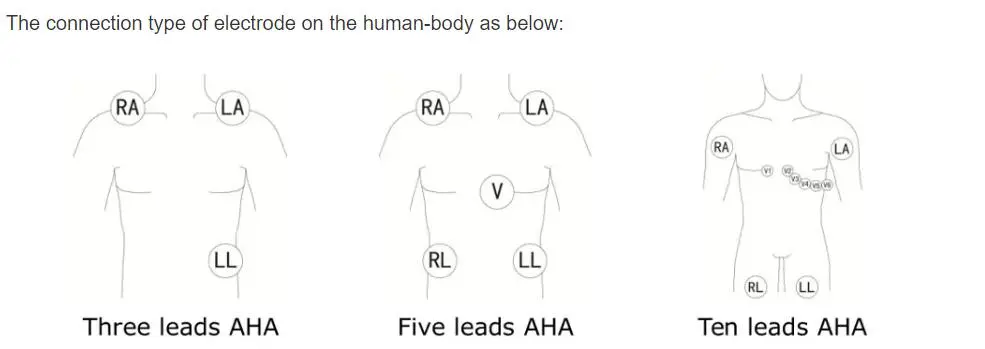 Sreangacha luaidhe 5-ECG do philips digitrak móide holter 24 uair an chloig 3100A, 5-luaidhe, Snap
